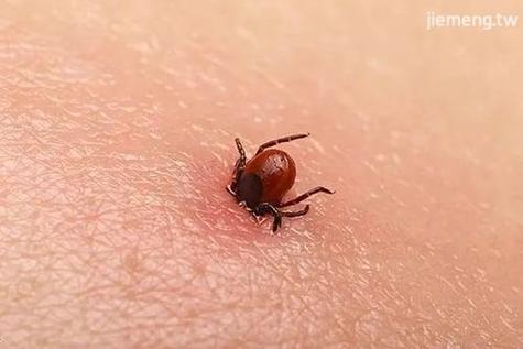 梦见从皮肤里挤出虫子，是何征兆？