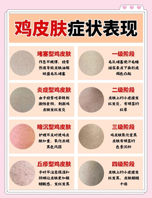 鸡皮肤怎么去掉？什么方法最有效？