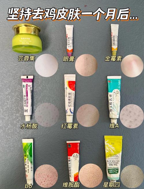 鸡皮肤怎么去掉?什么方法最有效?