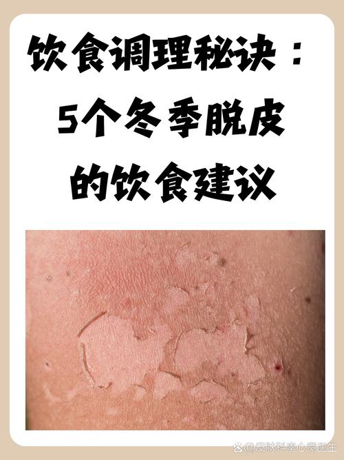 冬季吃什么能告别皮肤干燥?