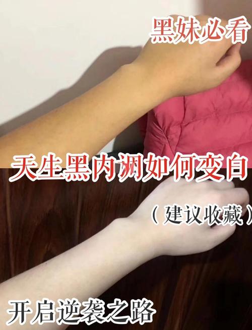 天生黑皮肤能变白吗？