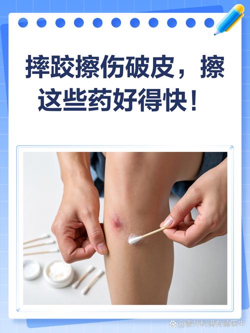 摔伤擦伤,涂什么药好得快?