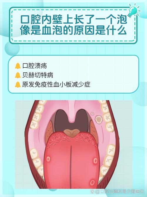 口腔上颚起水泡是何原因?