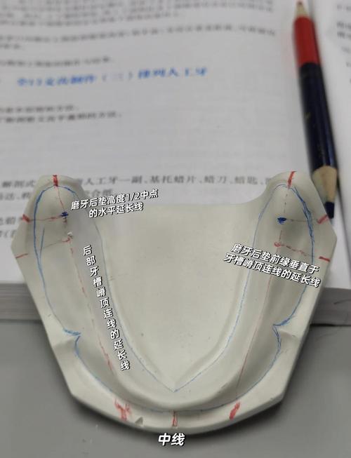 口腔石膏模型制作步骤是怎样的？