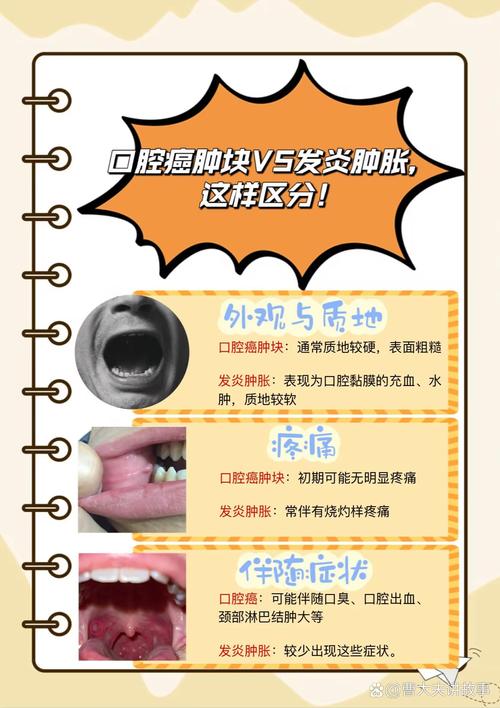 口腔脓肿究竟是如何引起的?