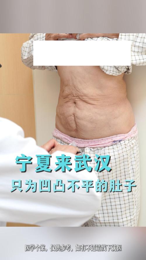 减肥后皮肤松弛怎么办?