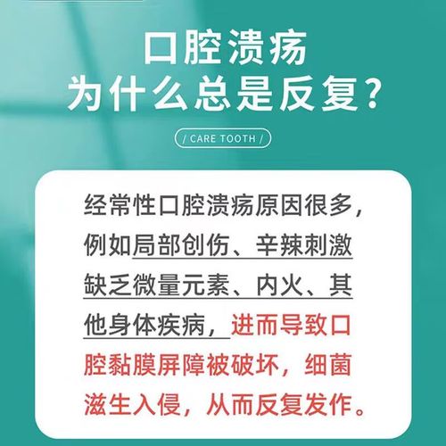 牙膏真能治口腔溃疡吗？