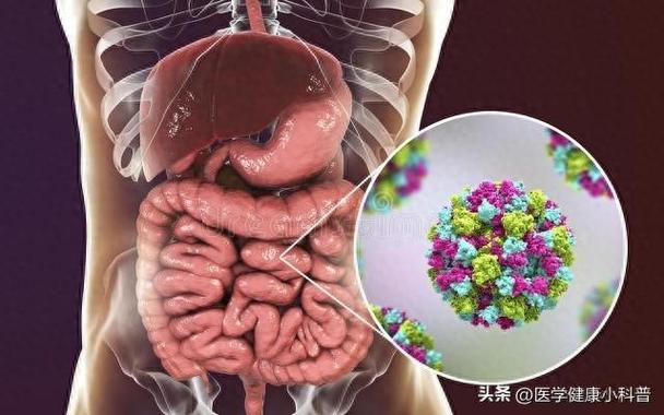 食物中毒与急性肠胃炎,如何区分?