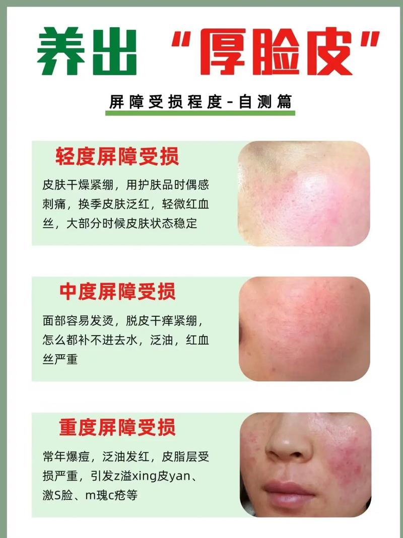 脸上皮肤修复到底要多久?