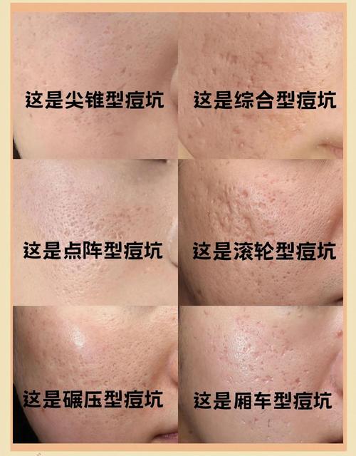 脸上皮肤修复到底要多久?