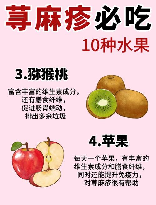 荨麻疹患者哪些食物绝对不能吃?