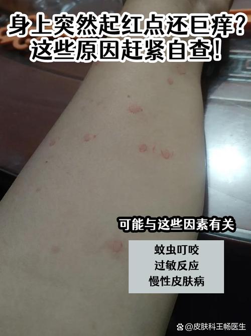 皮肤瘙痒是螨虫引起的吗?