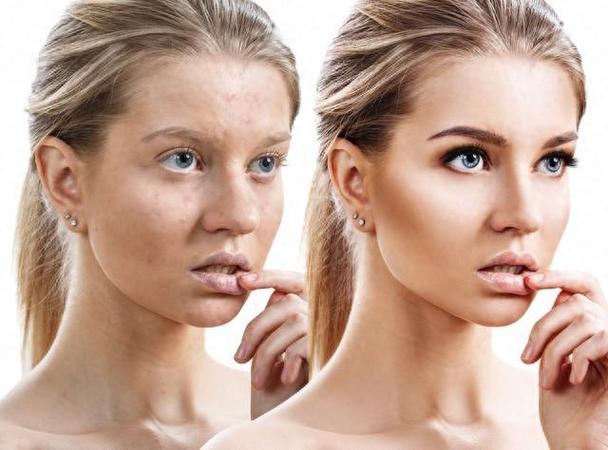 化妆�致皮肤变差？