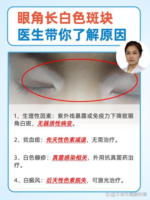 眼角皮肤变白是啥原因？