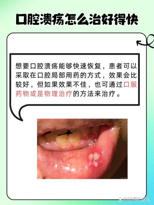 口腔粘膜损伤后,身体如何自行修复?