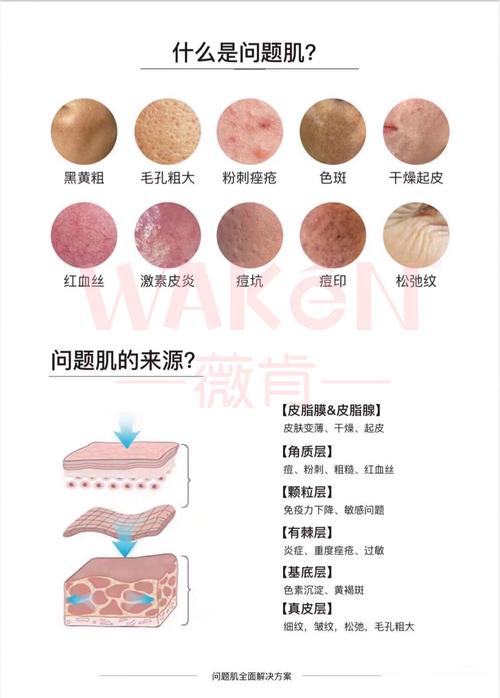 皮肤差元凶，饮食、作息还是压力？