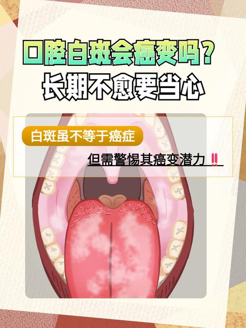 口腔内壁发白是何原因？