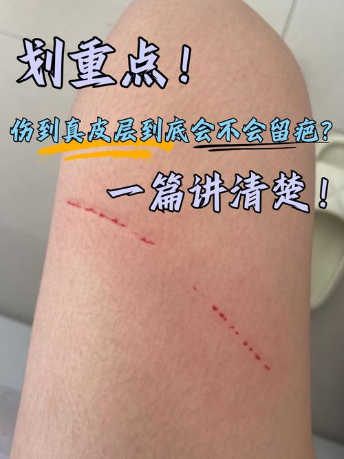 皮肤黏膜破损如何快速判断？