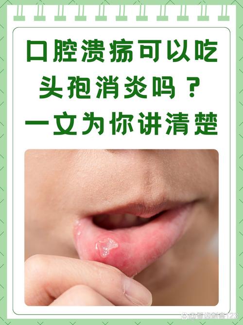 口腔溃疡外出就餐，如何避免伤口刺激？