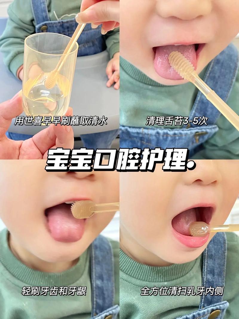 婴儿口腔奶垢怎么去除?
