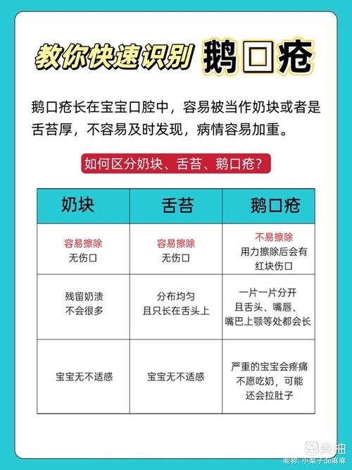 婴儿口腔奶垢怎么去除?