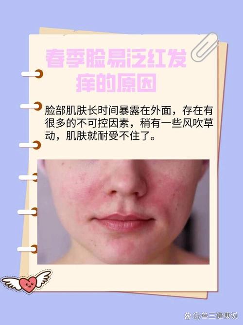 脸上过敏痒,怎么快速缓解?