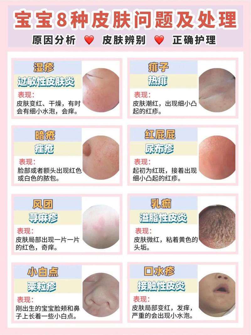 脸上过敏痒,怎么快速缓解?