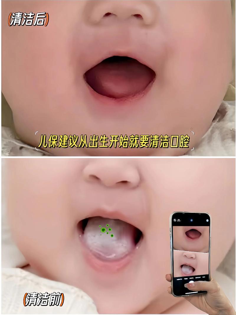 宝宝多大开始刷牙？护齿黄金期是几岁？