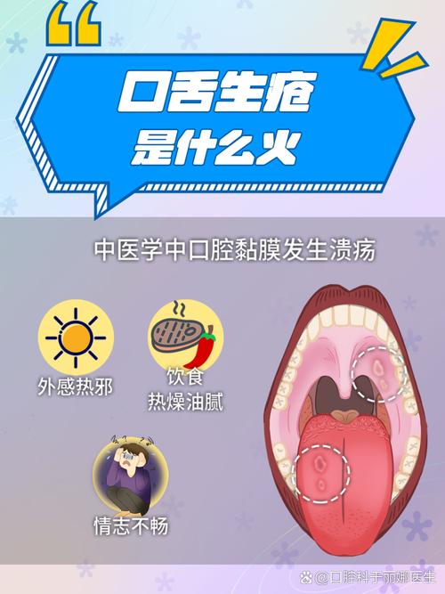 舌根溃疡反复发作是啥原因?