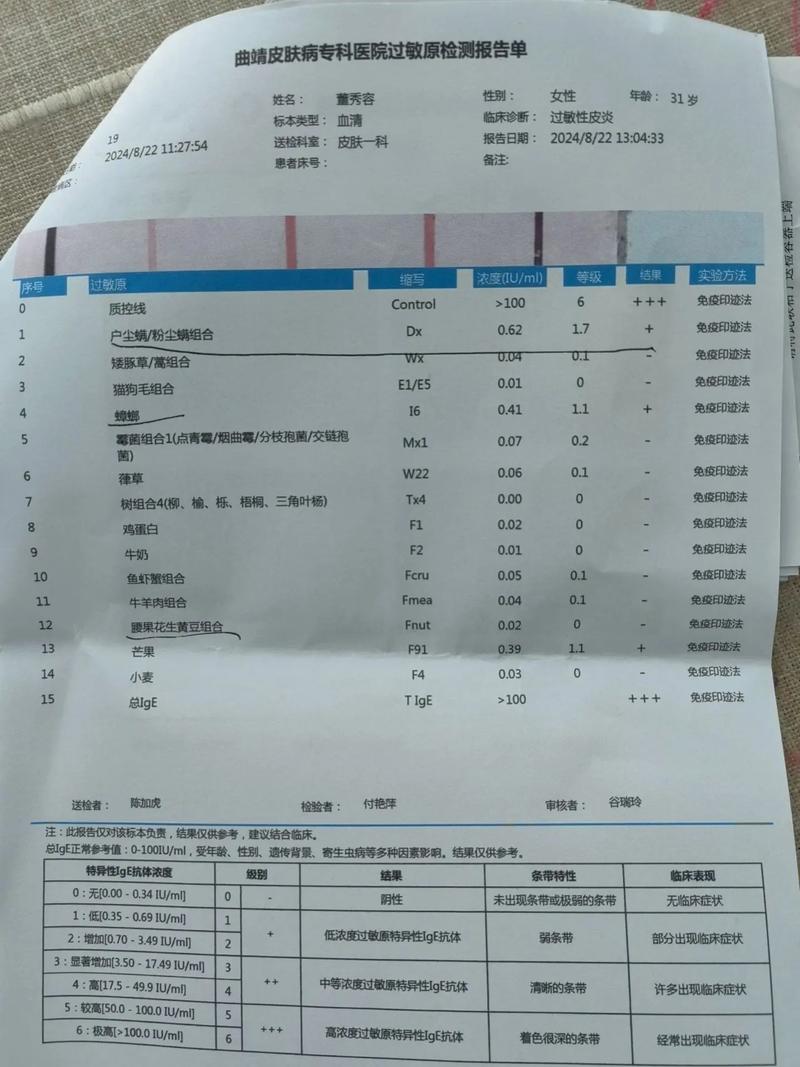 皮肤过敏源检查费用一般是多少?