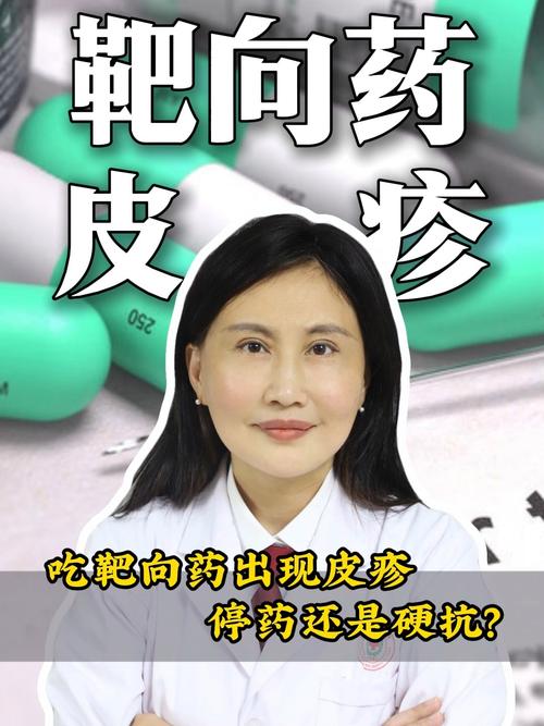 靶向药皮肤痒,如何缓解才安全?