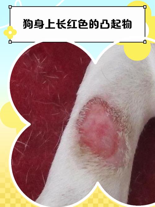 红色一圈是哪种皮肤病?