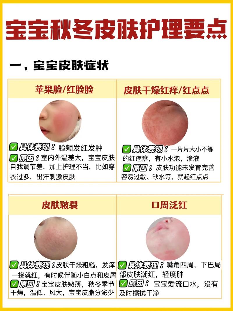 宝宝皮肤痒老抓,怎么快速止痒防抓伤?