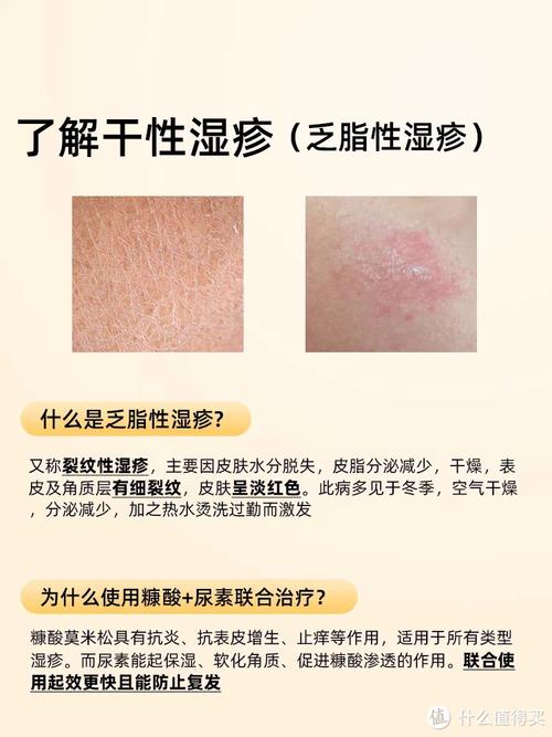 老年人皮肤痒,用什么药最安全有效?