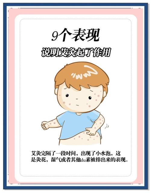 艾灸皮肤痒是排病还是过敏？