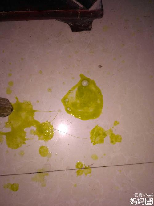 孩子吐的食物臭是消化问题还是生病了？