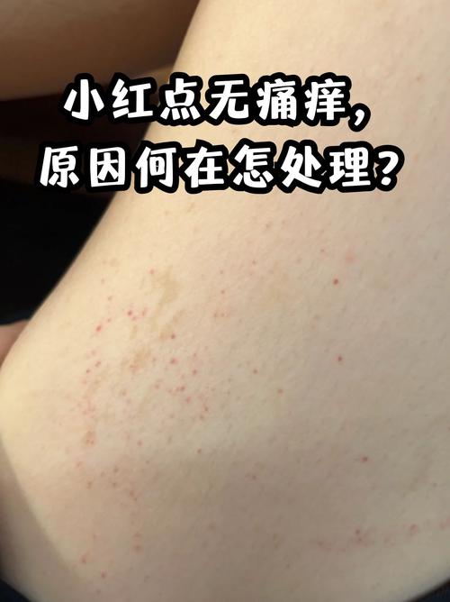 皮肤起小血点是什么原因导致的？