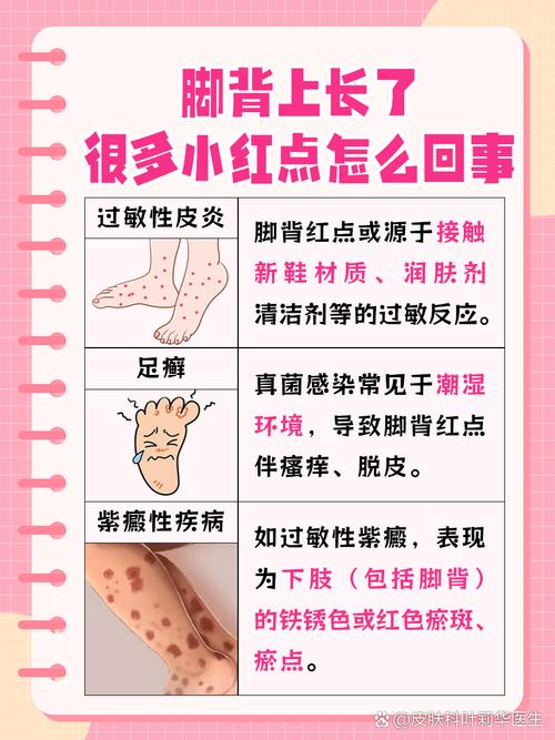 皮肤起小血点是什么原因导致的?