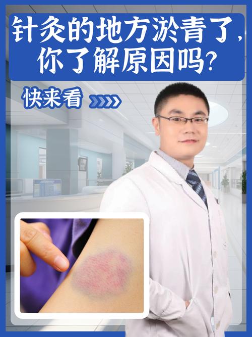 针灸后皮肤痒是何原因所致?