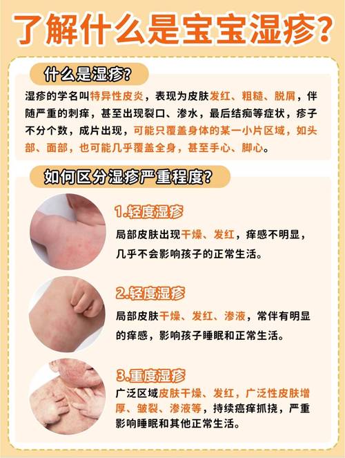 新生儿皮肤湿疹怎么护理才有效?