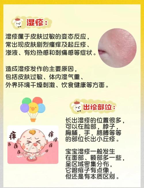 新生儿皮肤湿疹怎么护理才有效?