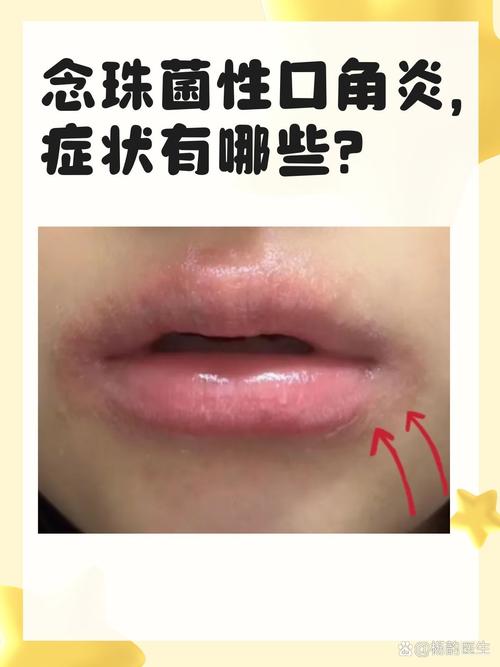 口腔过酸会有哪些症状?