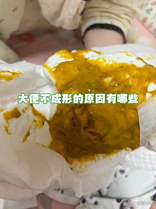 大便不成形有食物残渣,是消化出问题了?
