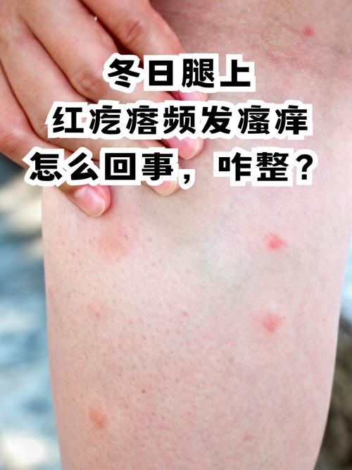 突然皮肤痒,是过敏还是疾病信号?