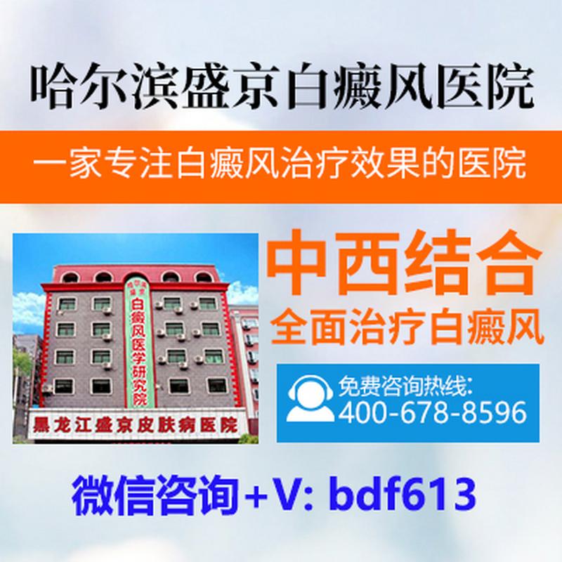 黑龙江盛京皮肤病医院正规吗？