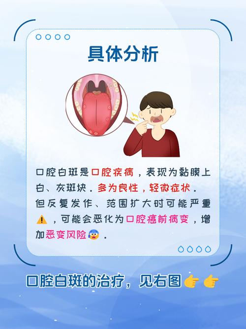 口腔内壁白斑不用怕？到底该咋办？