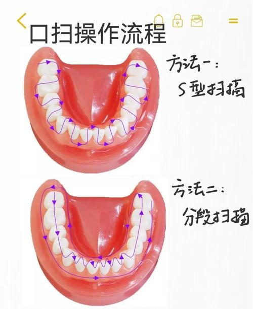 口腔检查有哪些具体步骤和方法?