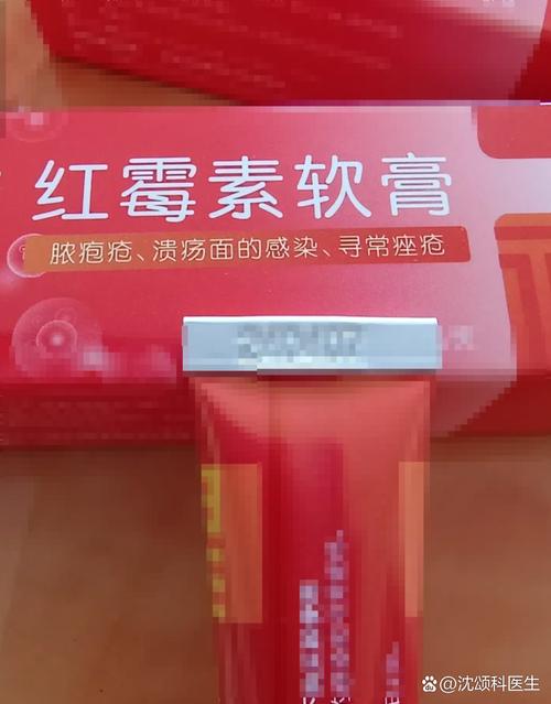 面部皮肤过敏,用药怎么选?