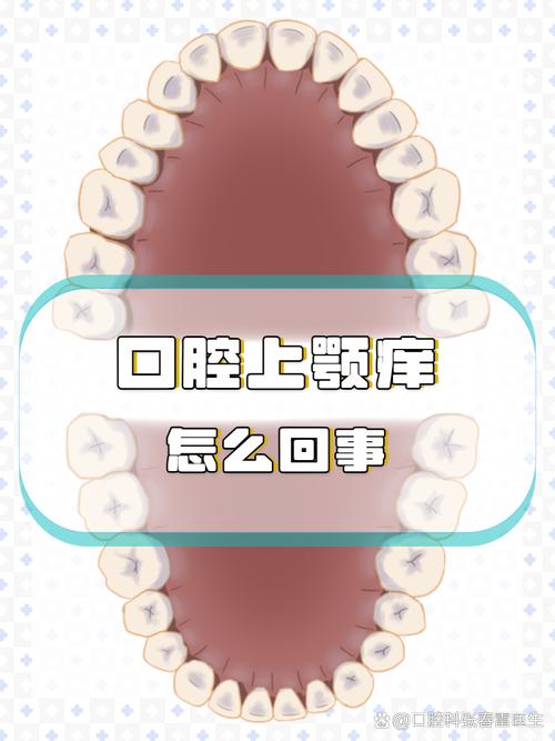 口腔上颚干燥是何原因导致?