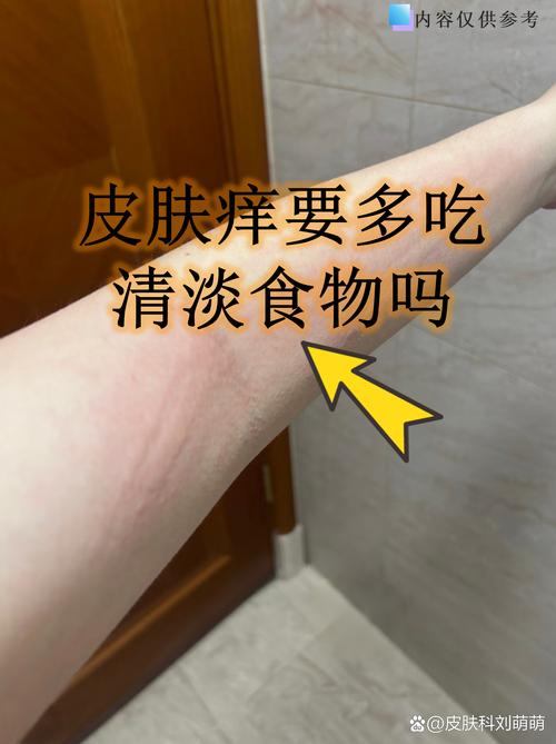 全身皮肤干痒,如何快速缓解?